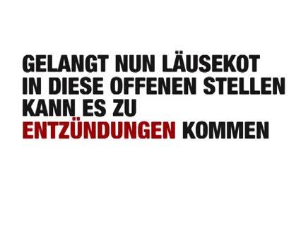 Kopfläuse besiegen. Hier ein paar Tipps!
