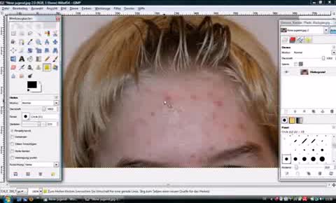Pickel mit GIMP entfernen 