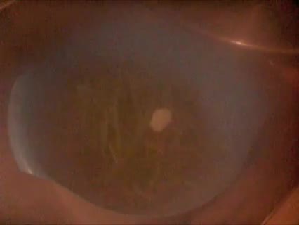 Kochen: Bohnen im Speckmantel